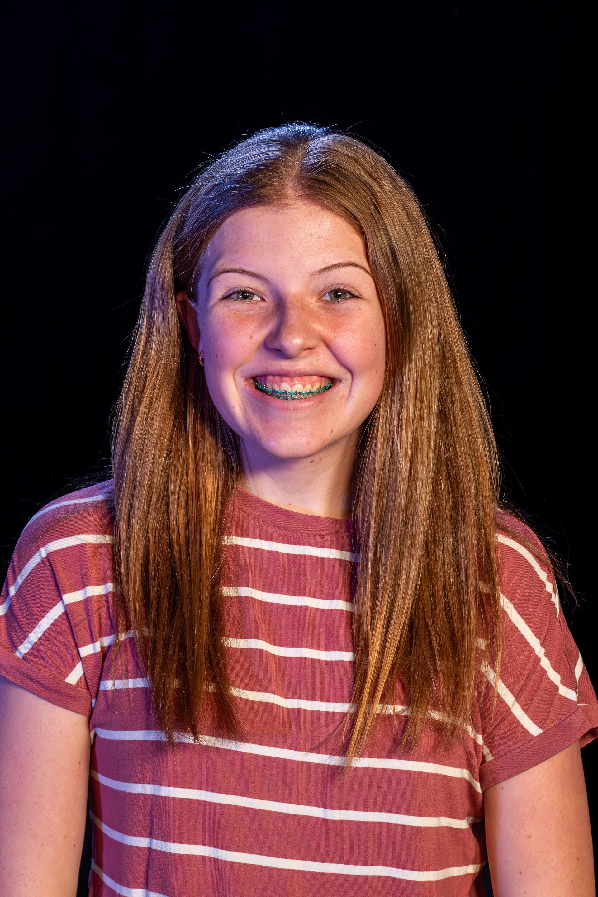 Young person with long red hair smiles, wearing a striped shirt and braces against a black background.