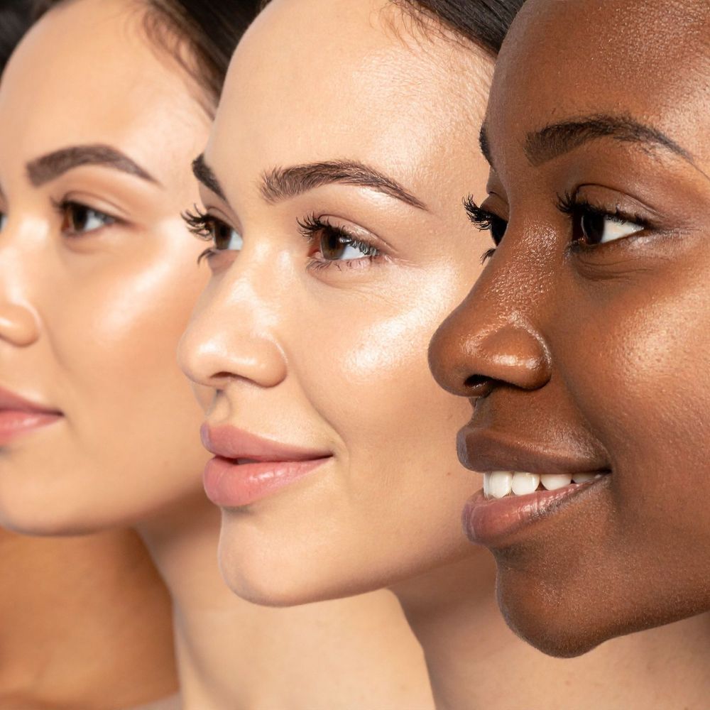 Even, well maintained facial skin photographed at a follow up appointment
