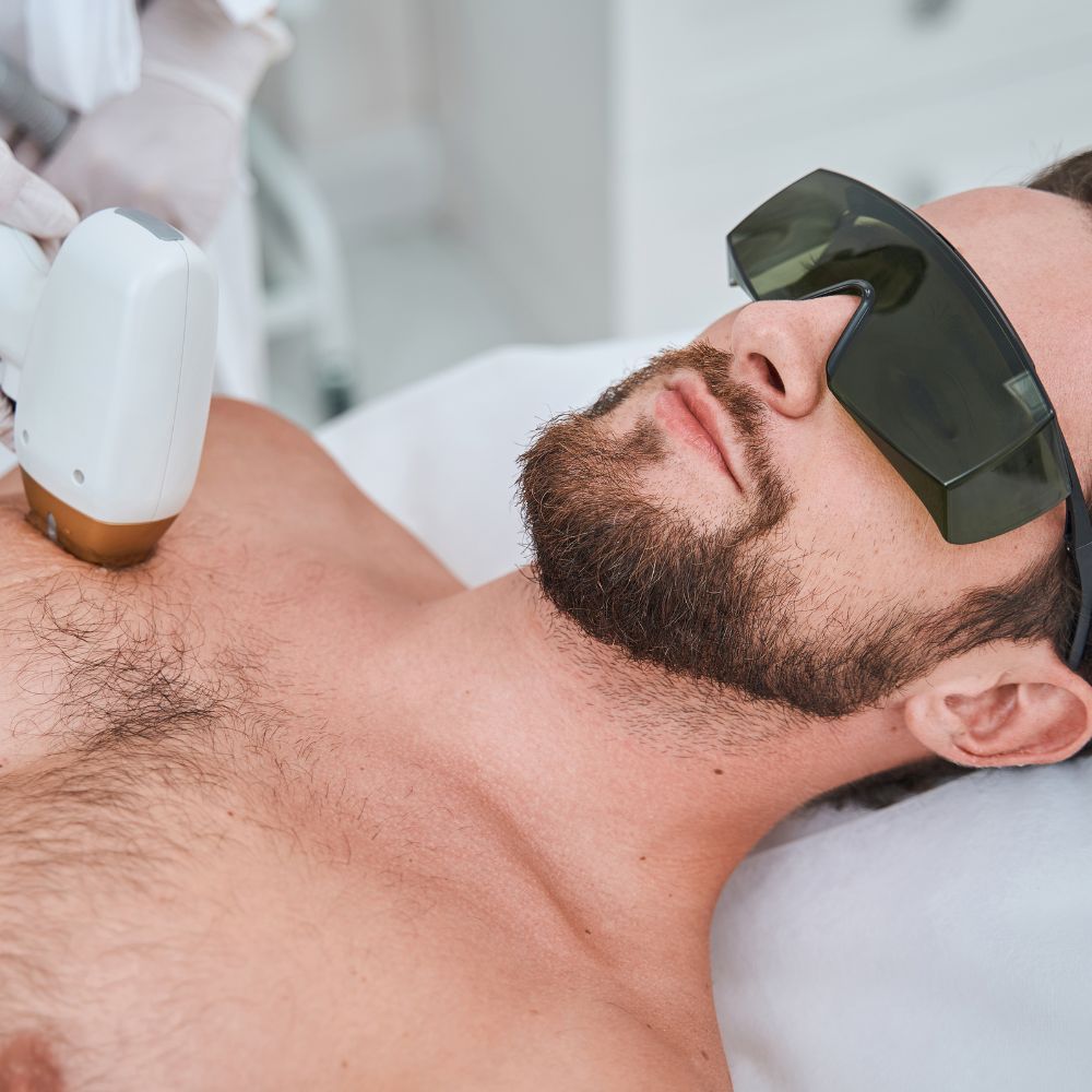 Laser hair removal being performed on a mans back during a planned course