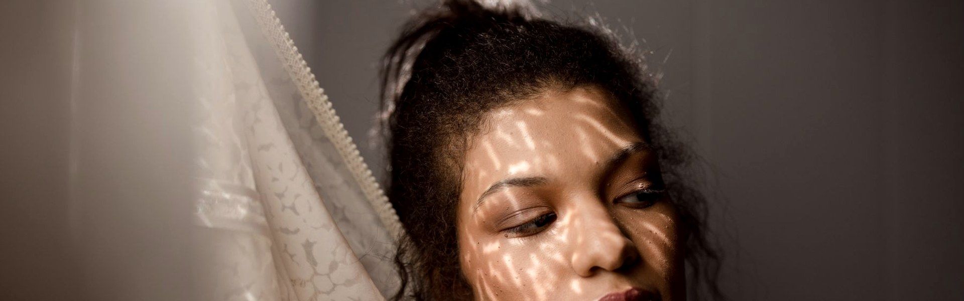 Melasma Treatment at AgeSmart in New City, New York