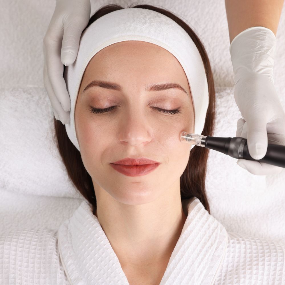 Sterile microneedling pen and single use cartridge prepared for a treatment
