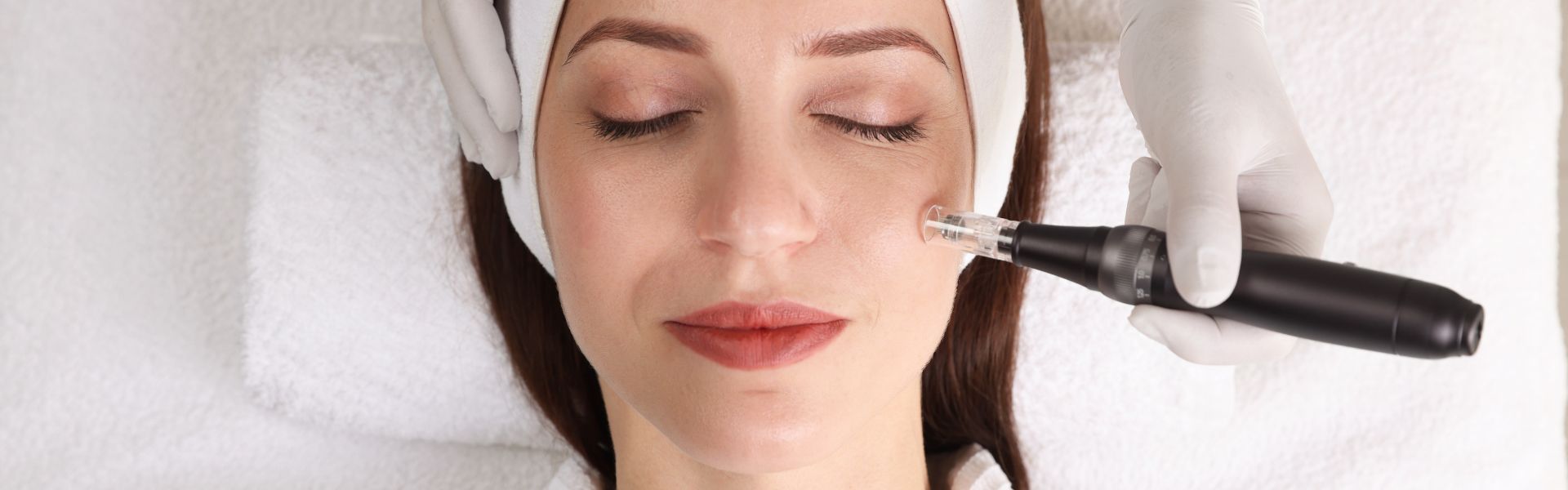 Microneedling at AgeSmart in New City, New York