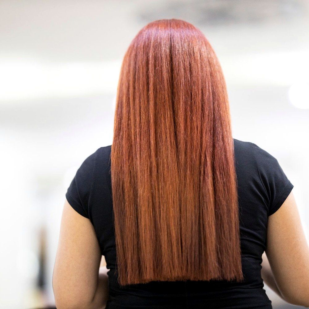 Scalp being mapped in sections before a course of PRP hair restoration