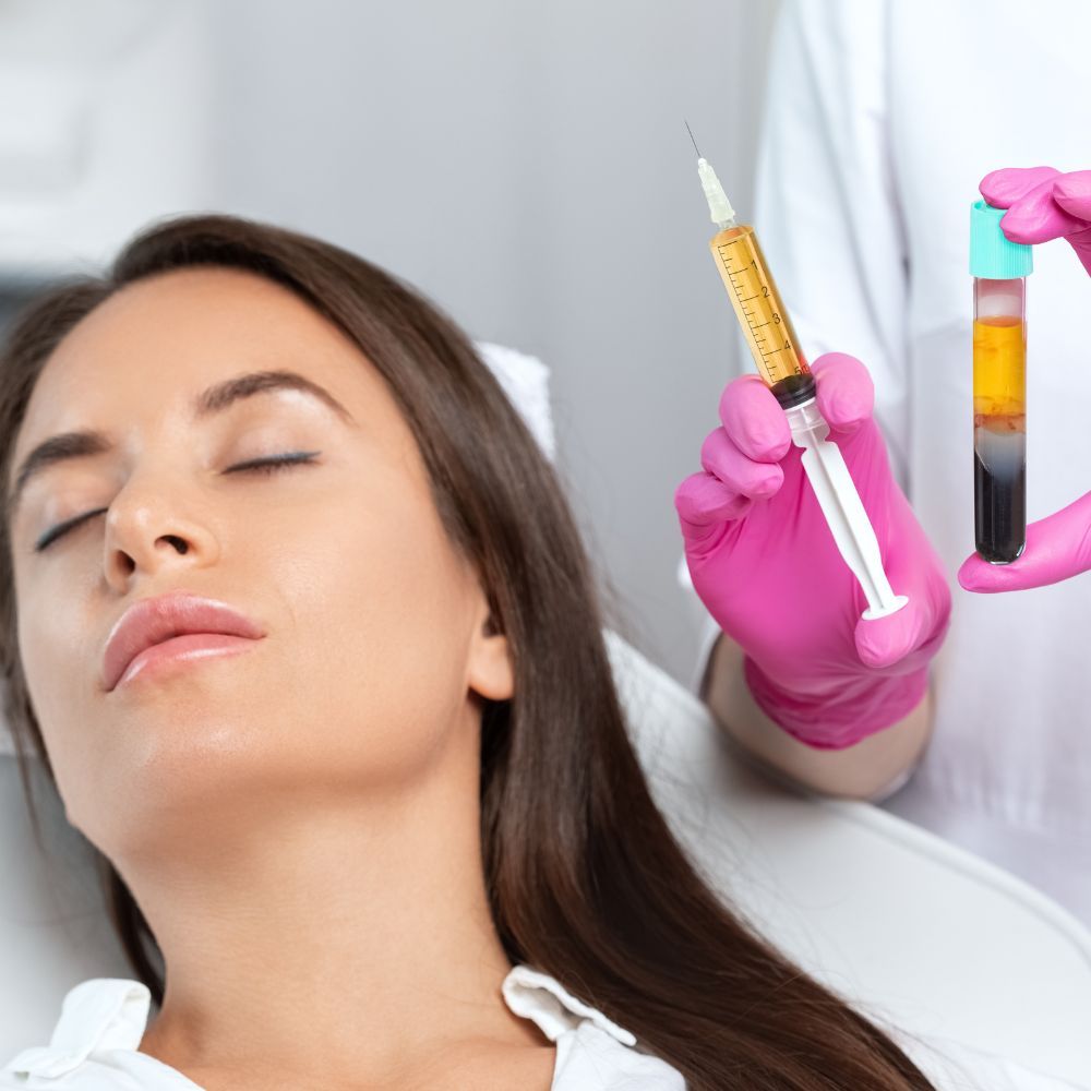 Concentrated platelet rich plasma being applied during a microneedling session