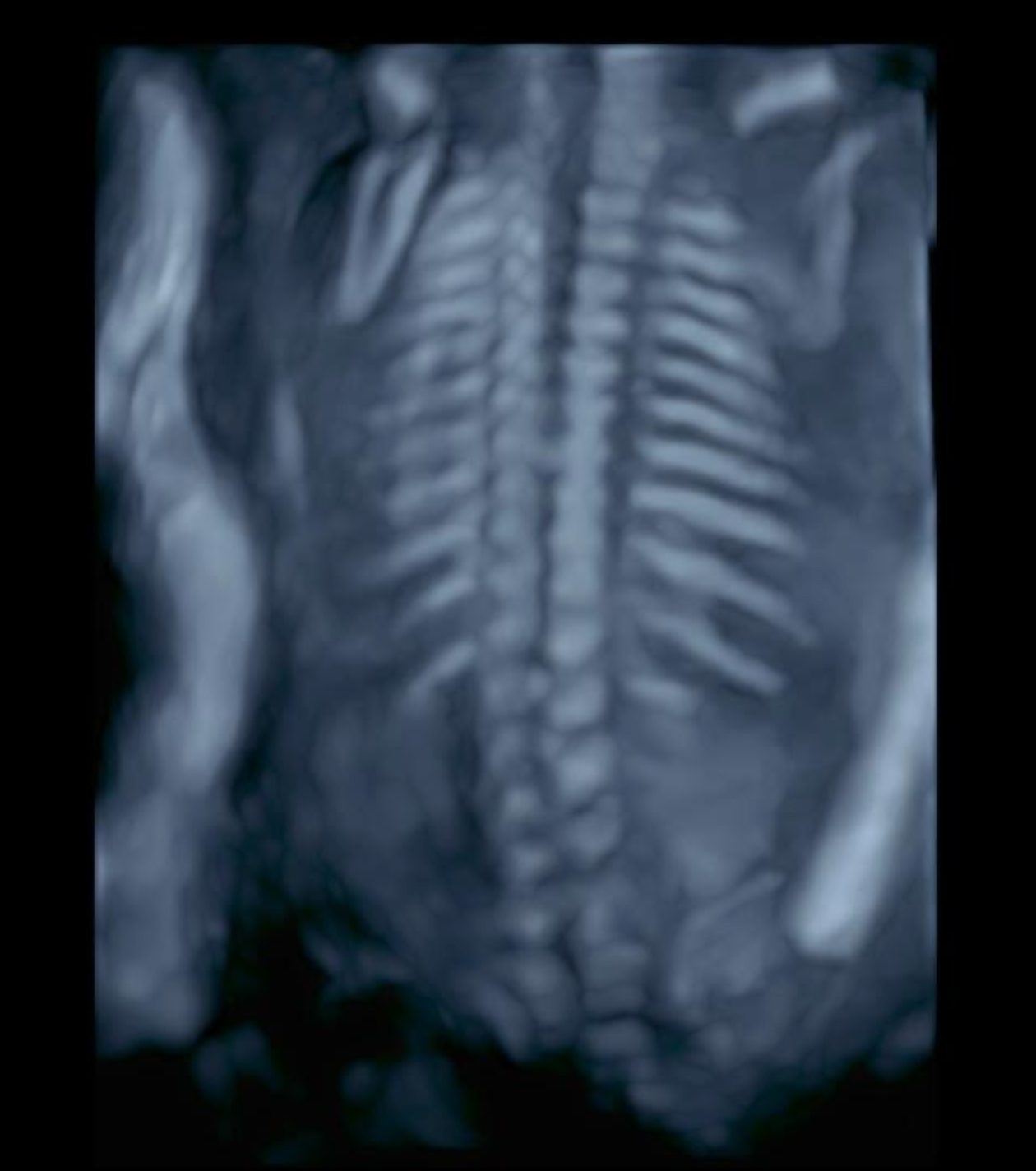 Ecografía fetal que muestra la columna vertebral y la caja torácica de un bebé en desarrollo.