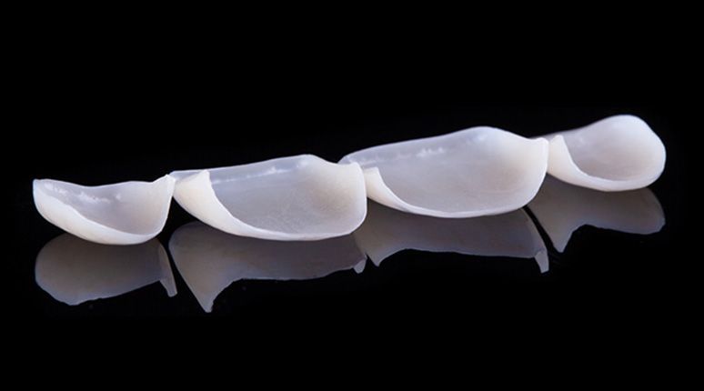 One of the most impressive veneer technologies is now available from Bant Dental
