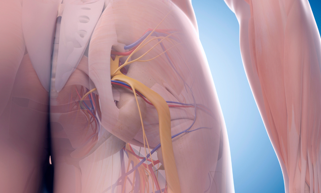 Anatomical view of the sciatic nerve and surrounding blood vessels in the human hip and buttock region.
