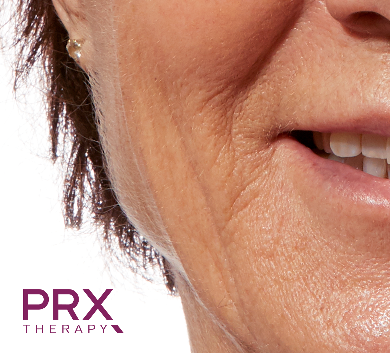 Eine Nahaufnahme eines Frauengesichts mit der Aufschrift „PRX-Therapie“ auf der Unterseite