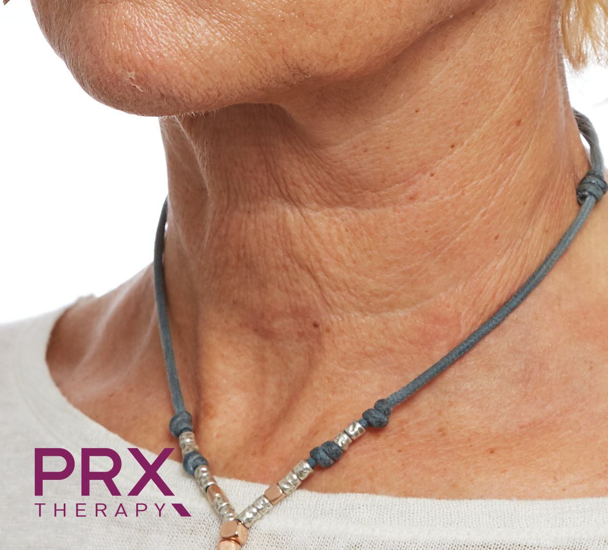 Eine Frau, die eine Halskette mit der Aufschrift „PRX-Therapie“ trägt