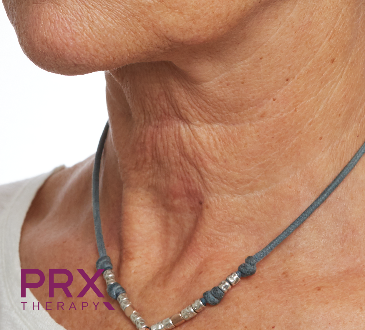 Eine Frau, die eine Halskette mit der Aufschrift „PRX-Therapie“ trägt