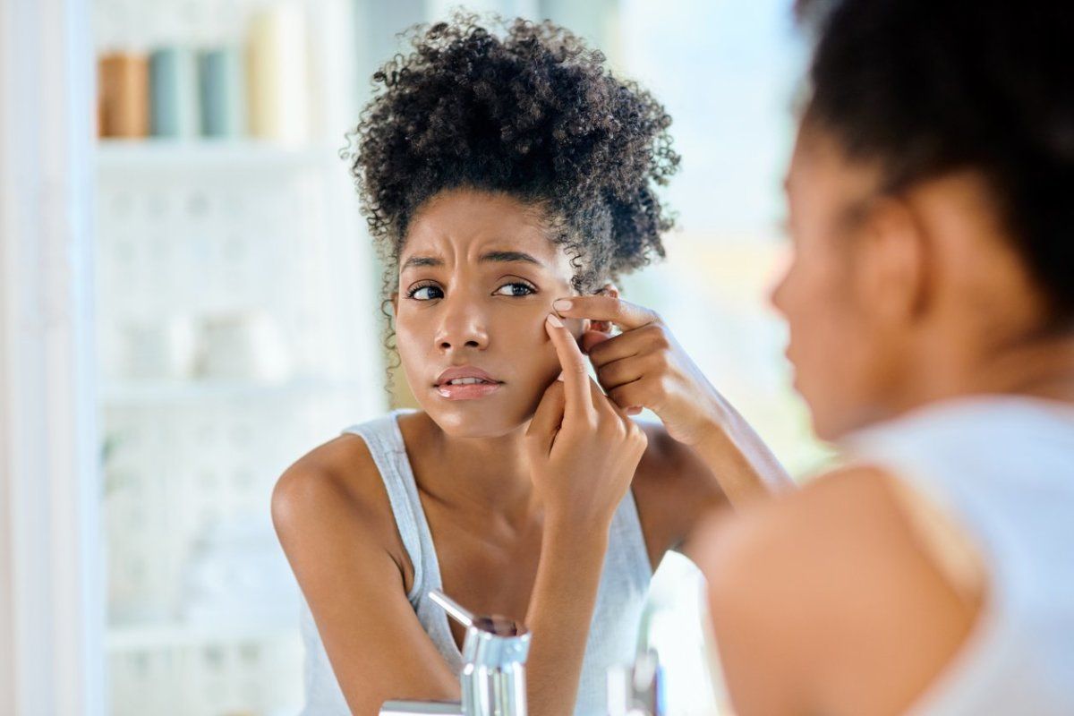 causes of acne symptoms of acne, cysts, nodules papules closed comedones open comedones