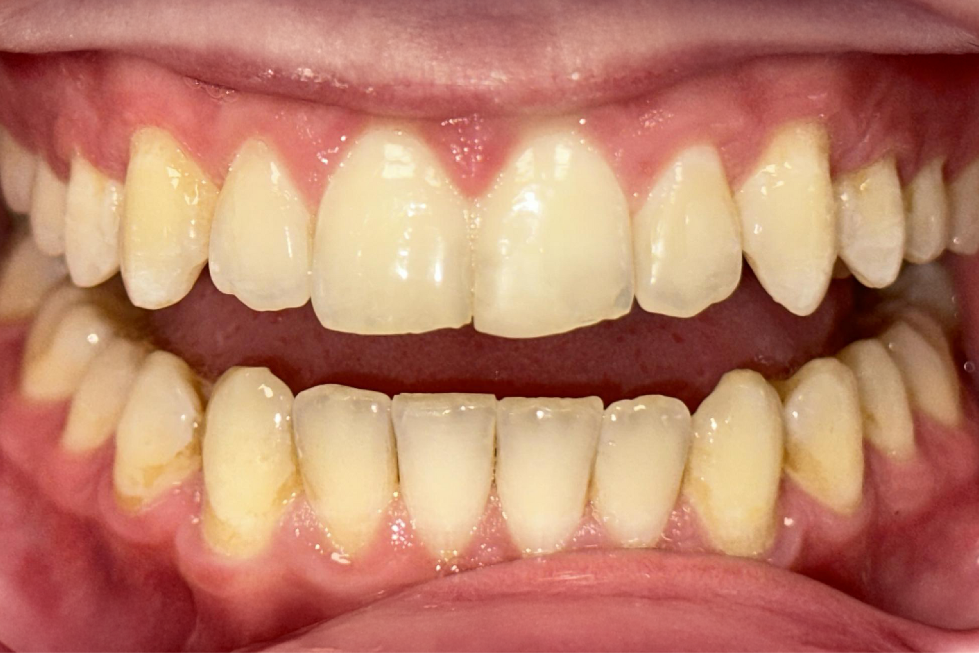 Blue Heron Dental Centre - Smile Gallery