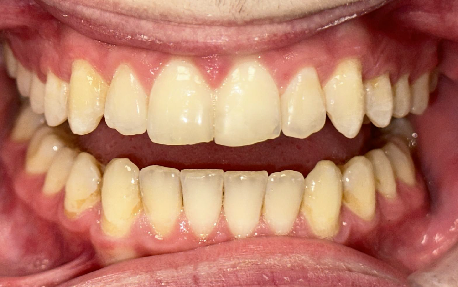 Blue Heron Dental Centre - Smile Gallery