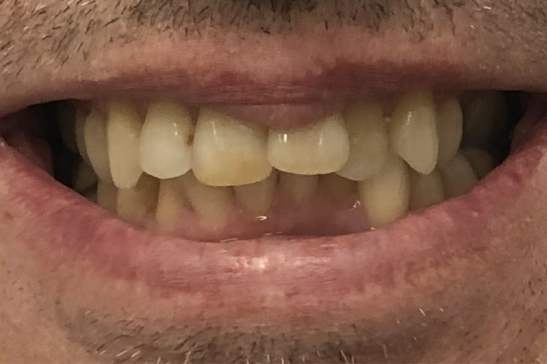 Blue Heron Dental Centre - Smile Gallery