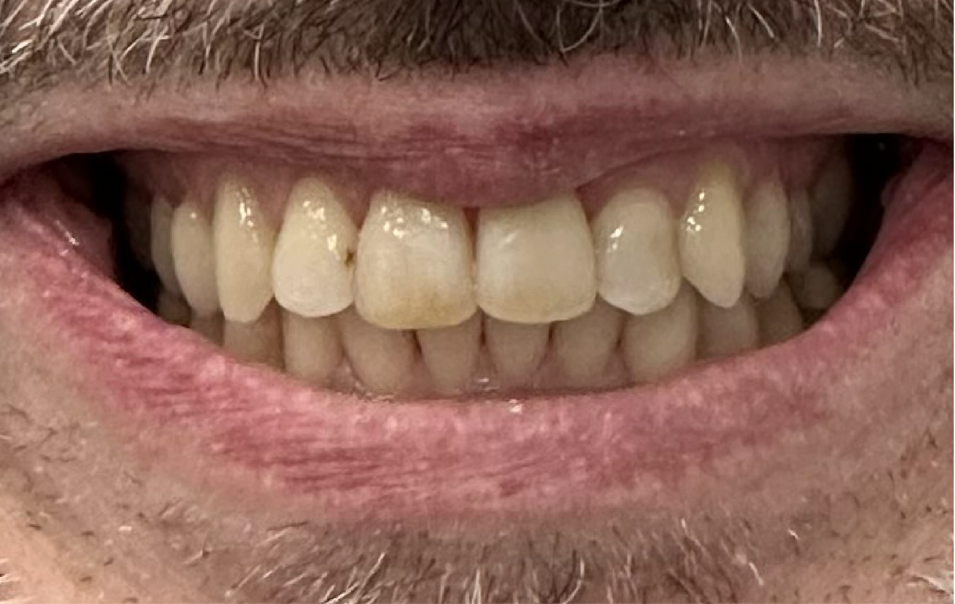 Blue Heron Dental Centre - Smile Gallery