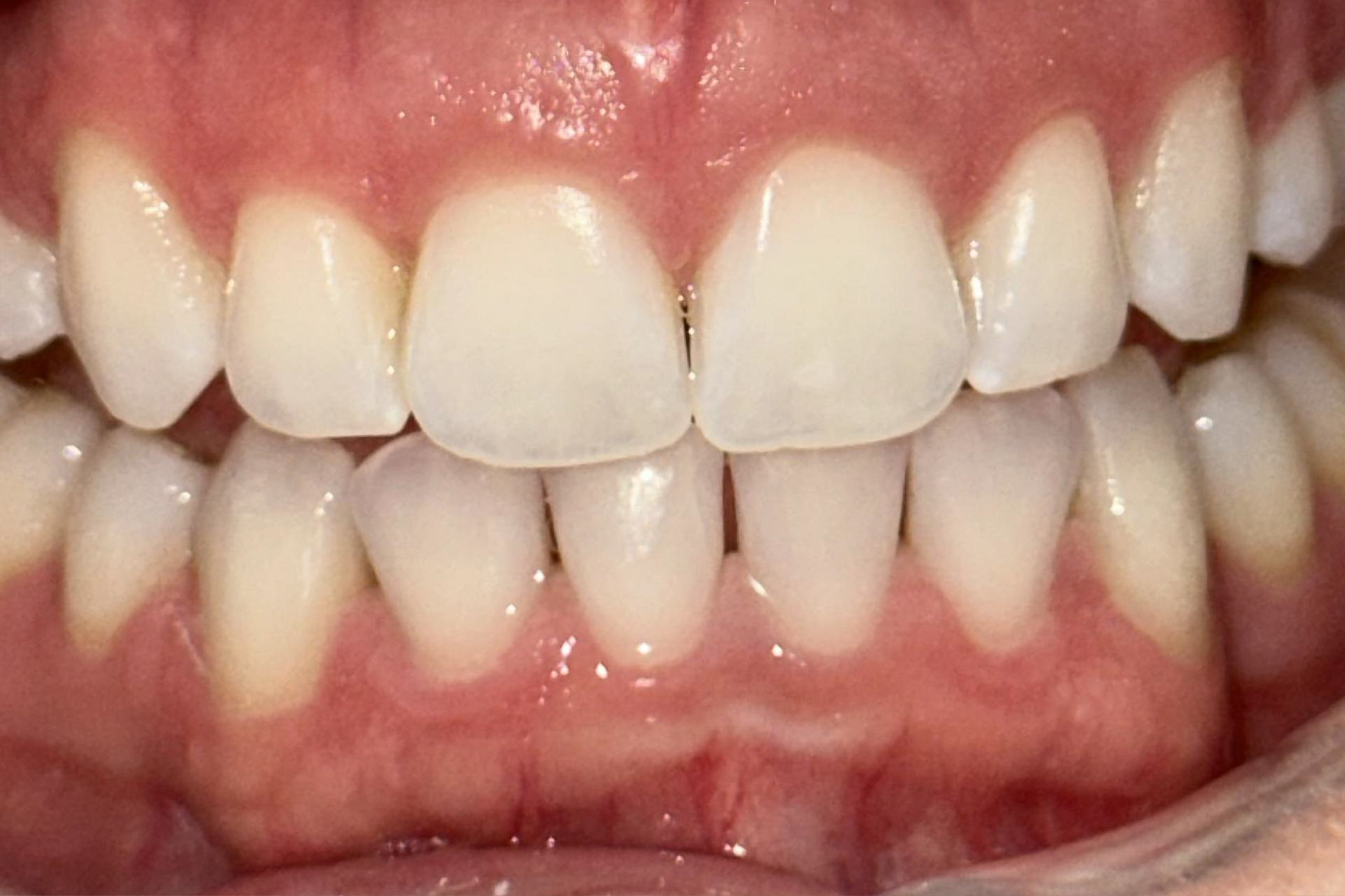 Blue Heron Dental Centre - Smile Gallery