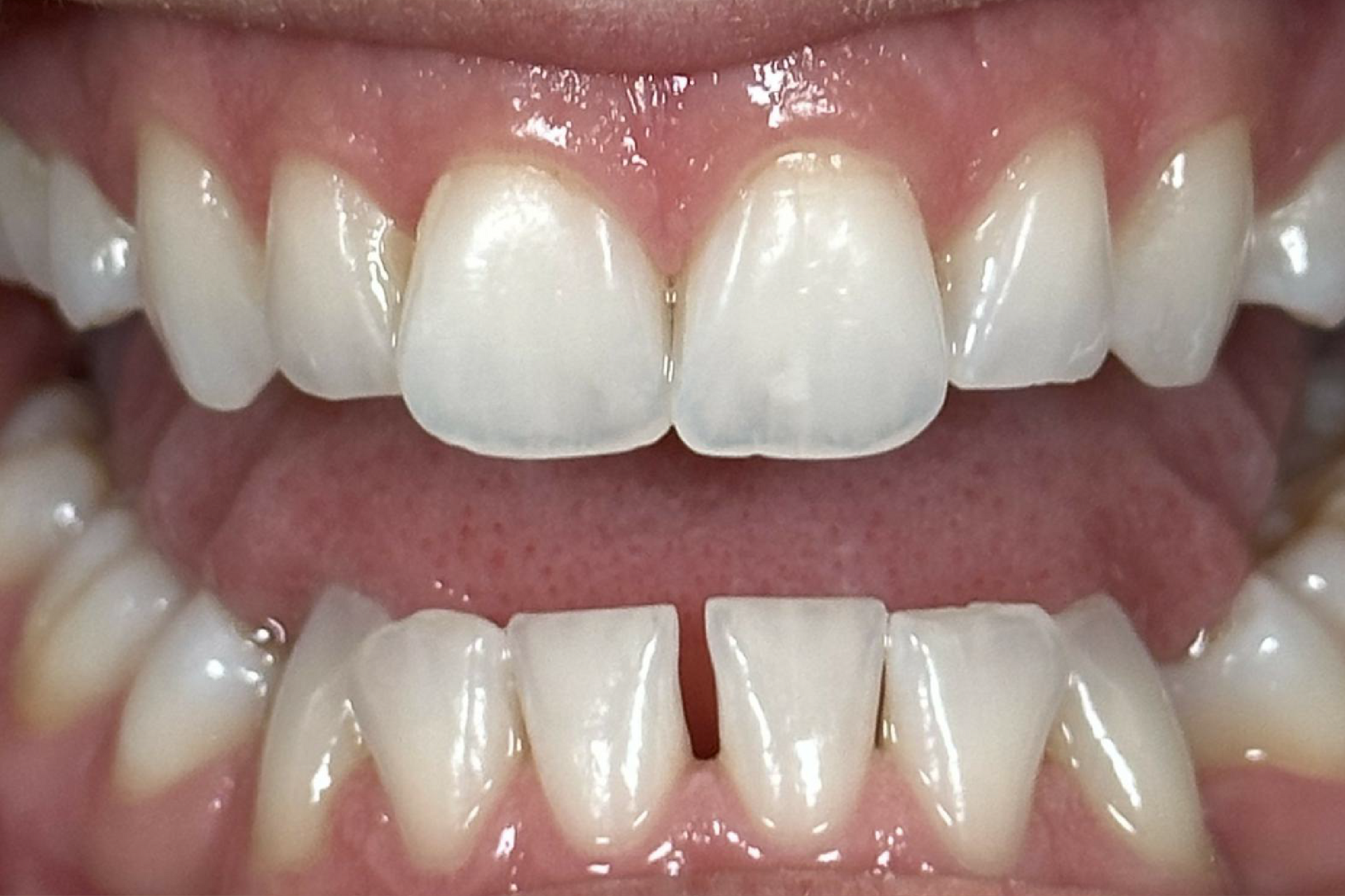 Blue Heron Dental Centre - Smile Gallery