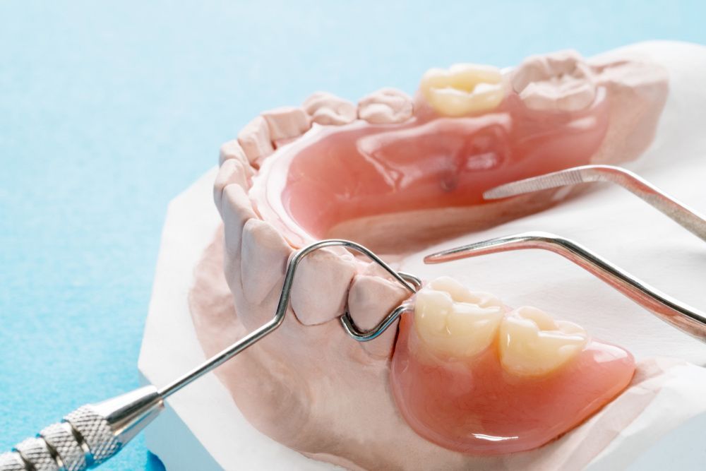 A Close Up of a Dental Model With a Denture and a Dental Probe — Ballina Denture Clinic Michael J Parker in Ballina, NSW