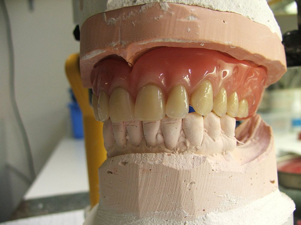 A Model of a Person's Teeth is Sitting on a Table — Ballina Denture Clinic Michael J Parker in Ballina, NSW