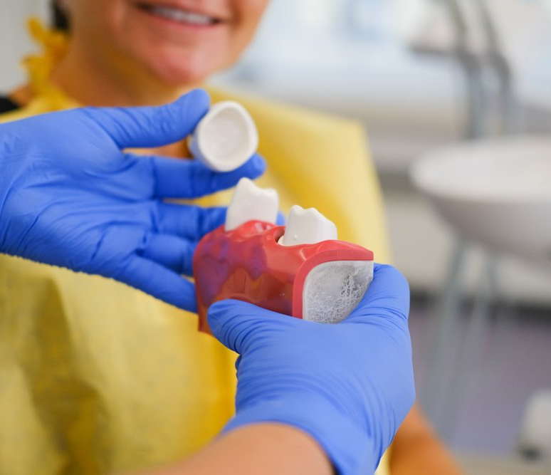 A dentist is holding a model of a woman 's teeth.