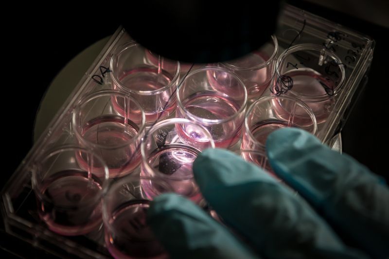 A lab technician in gloves examines a cell culture plate with pink liquid under a microscope.