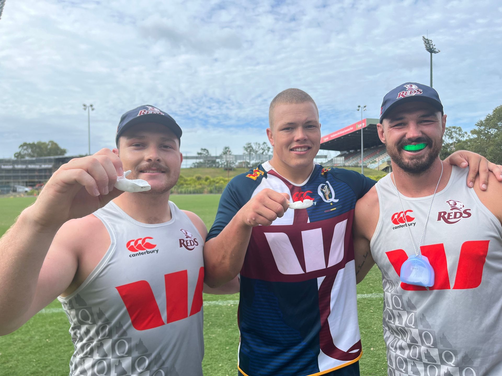 custom mouthguards toowoomba