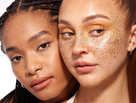 Two women with freckles on their faces are standing next to each other.