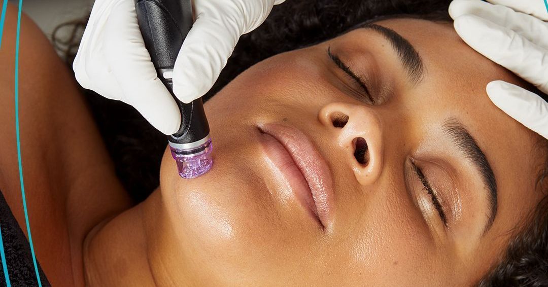 prp for hair restoration