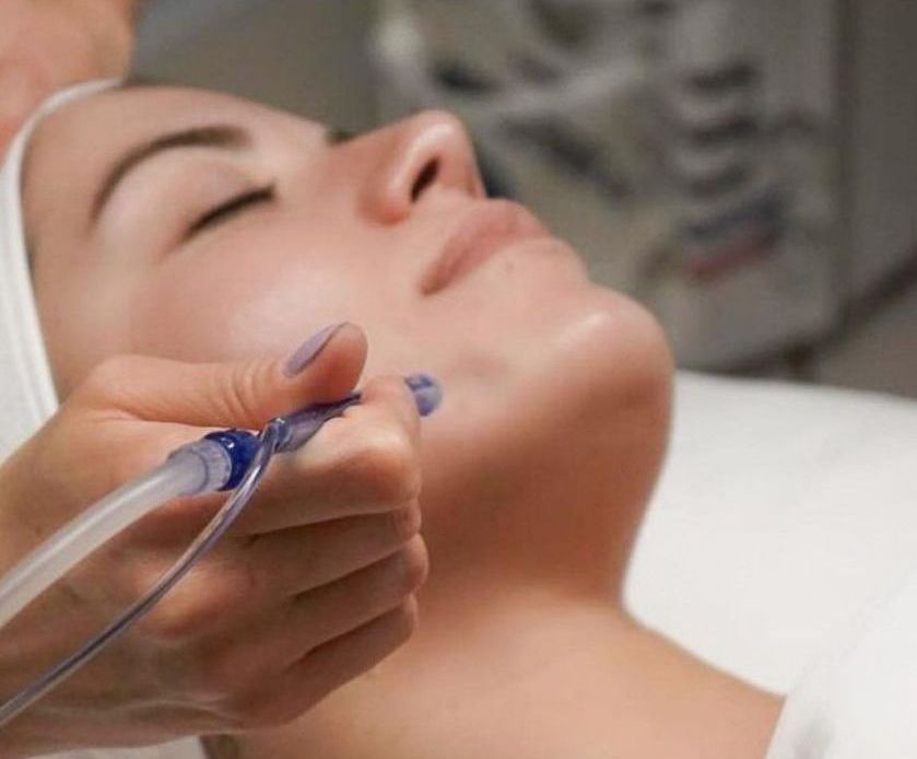 jetpeel facial