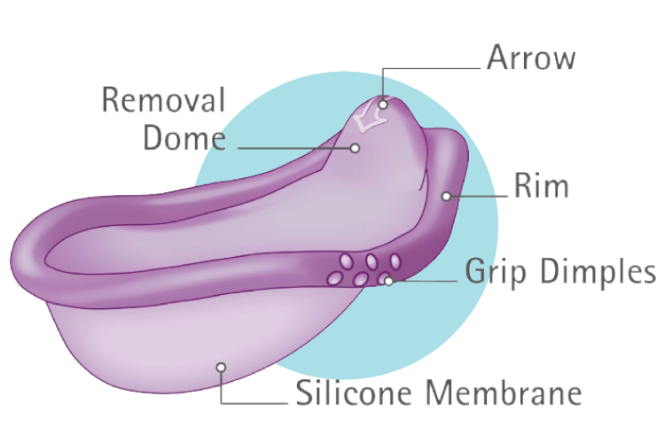 Caya Diaphragm users guide