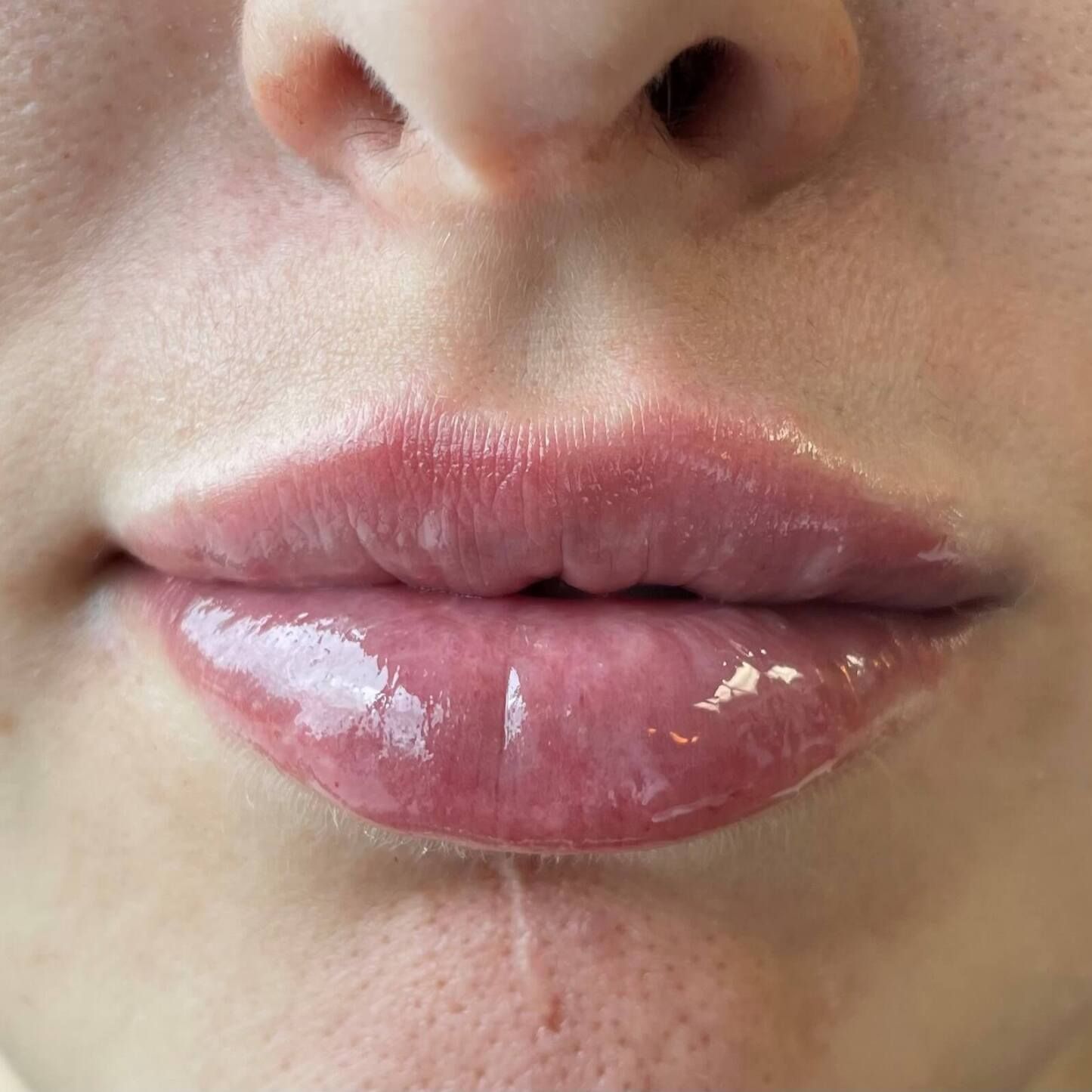 Close-up of glossy pink lips on pale skin.