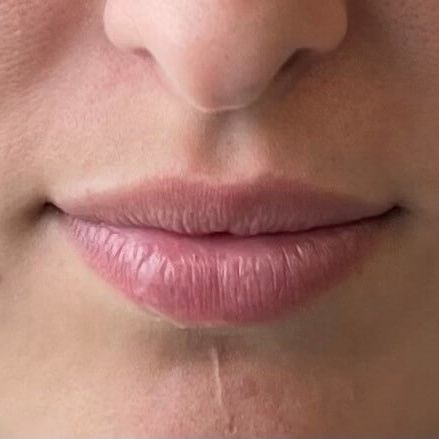 Close-up of a person's lips and part of their nose, showing pale pink lips and skin.