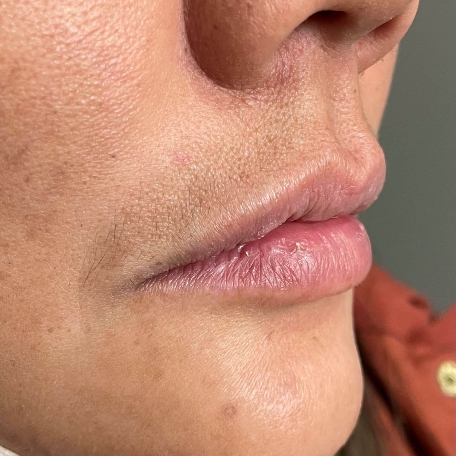 Close-up of a person's lips. The lips are full and slightly pink. Skin is tan with slight imperfections.