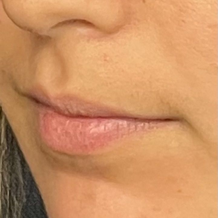 Close-up of a person's lips and part of their nose, showing pale pink lips and slightly textured skin.