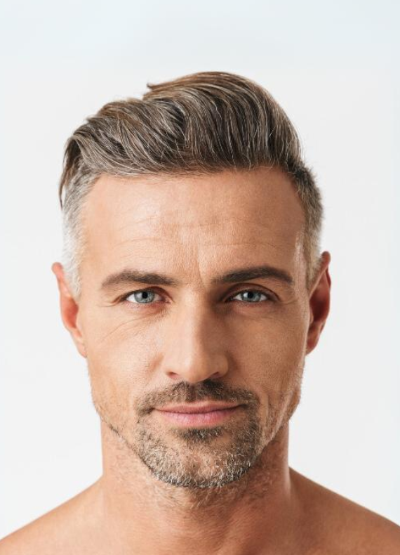 An older woman is getting a Dysport treatment near her lips to look younger.