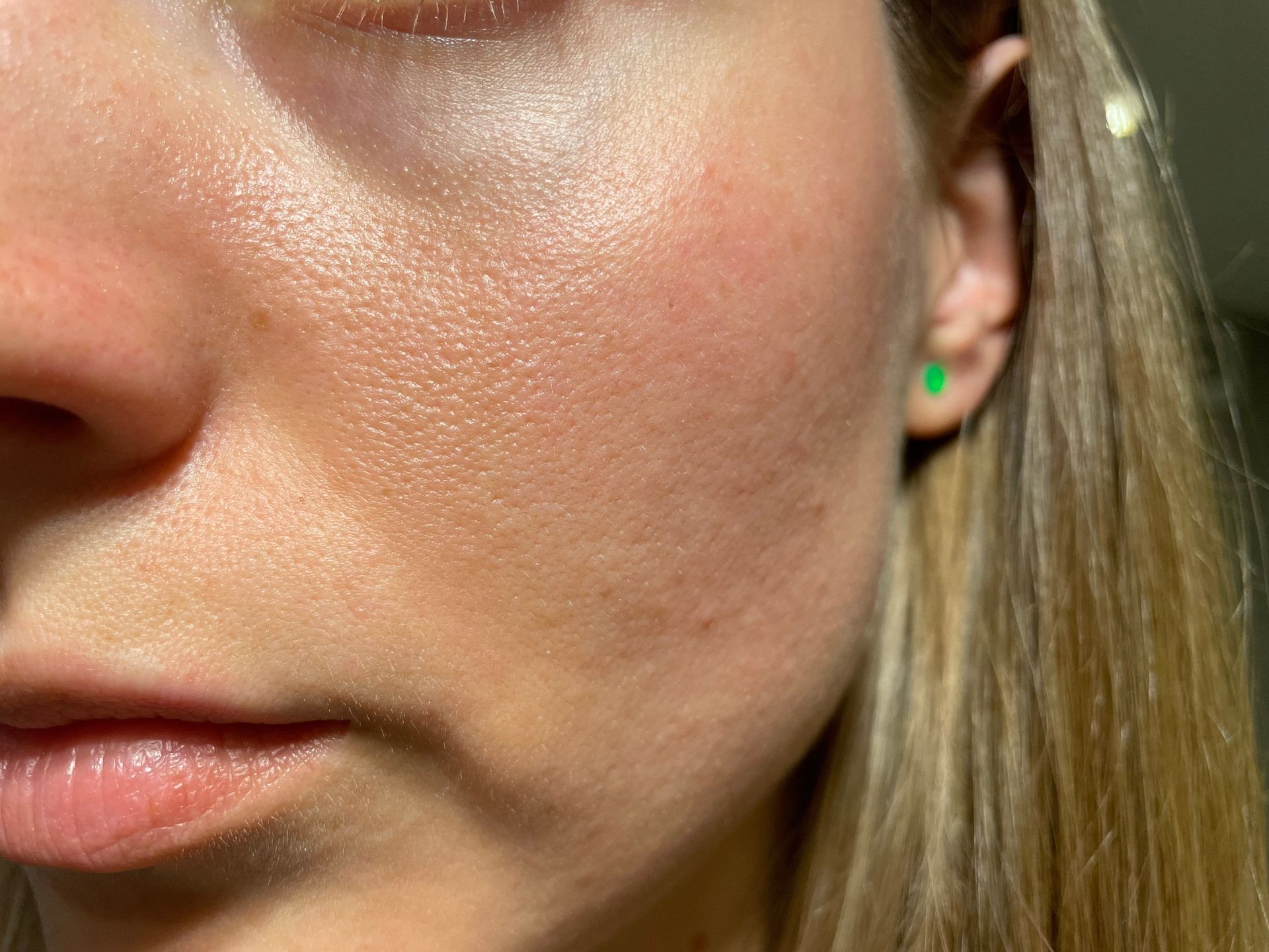Close-up of a person's face; fair skin, visible pores, slight blush, and a small green earring.