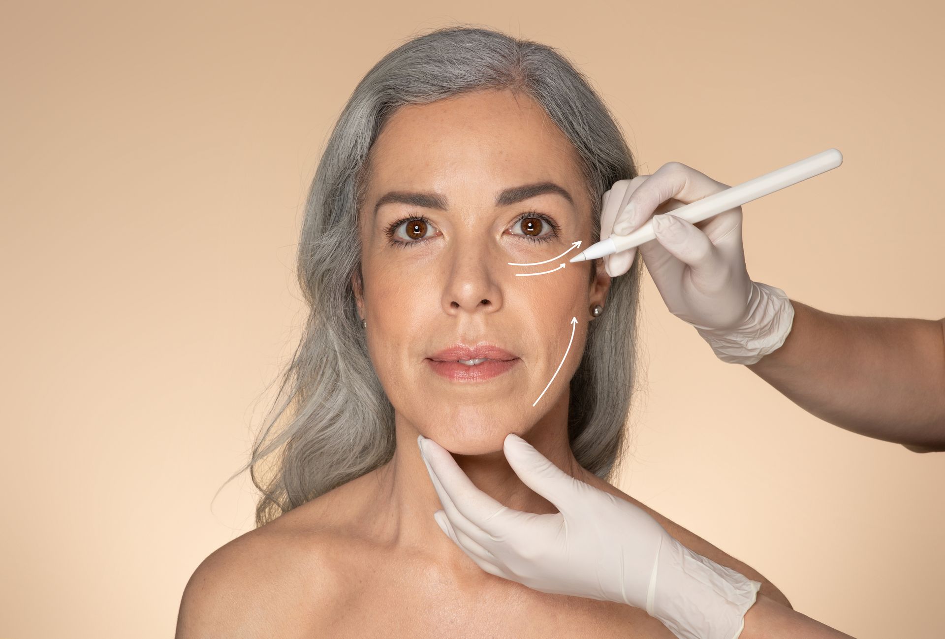An elderly woman showing her face before Stylage Dermal Fillers treatment.
