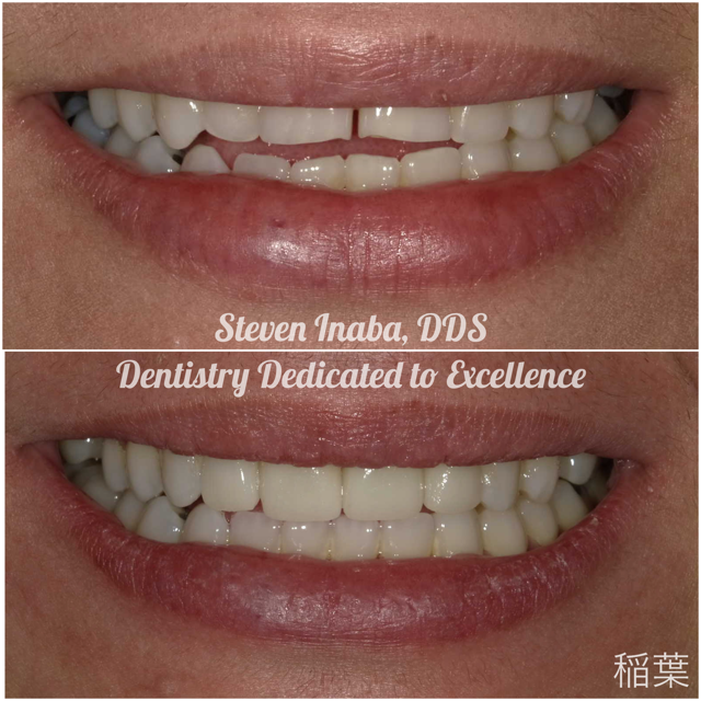 Steven inaba dds dentistry dedicated to excellence