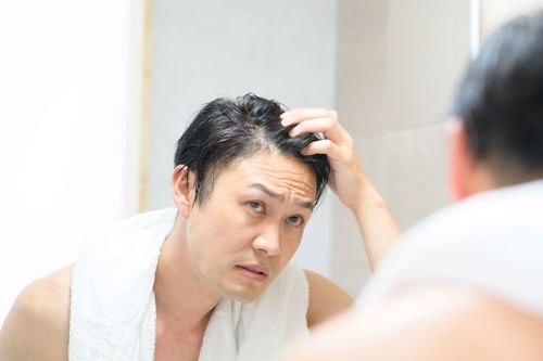Man in a white robe examining his hair in a bathroom mirror, touching his scalp with a concerned expression
