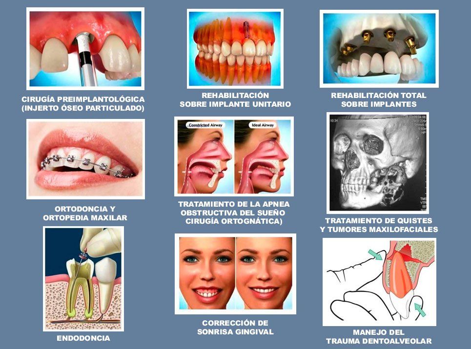 Odonto - GMA, clínica dental en Jesús María.