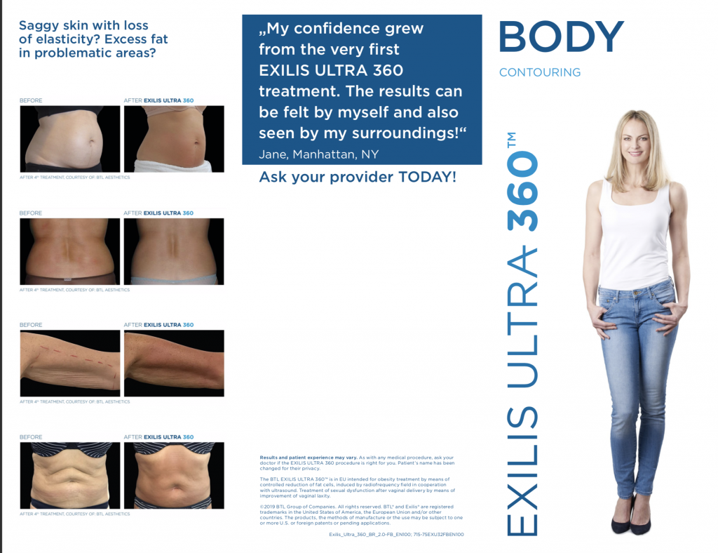 A woman is standing in front of an ad for exilis ultra 360