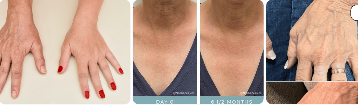 Aging hands and chest