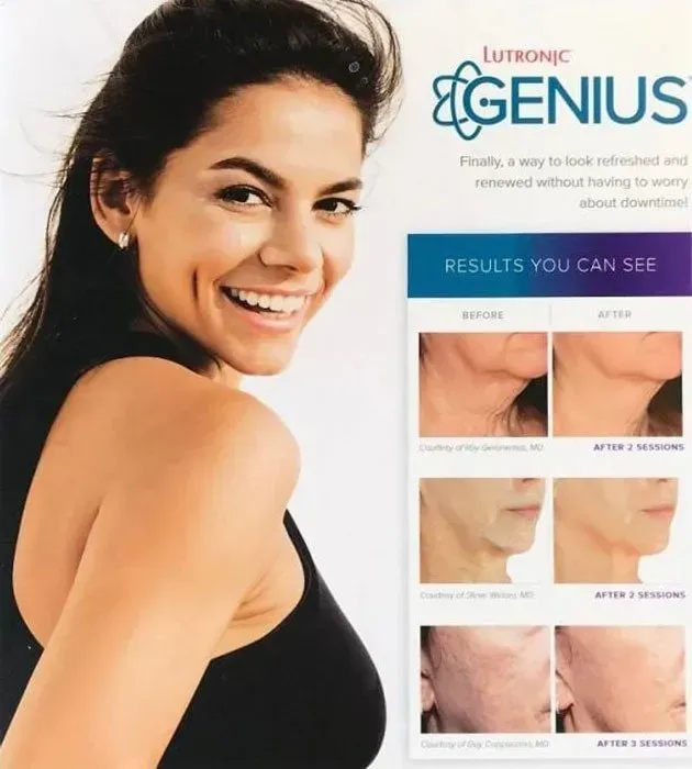 RF Microneedling— Wall, NJ —Mirelle Anti Aging RF Microneedling— Wall, NJ —Mirelle Anti Aging