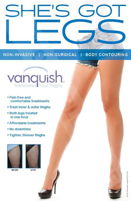 A poster that says she 's got legs vanquish
