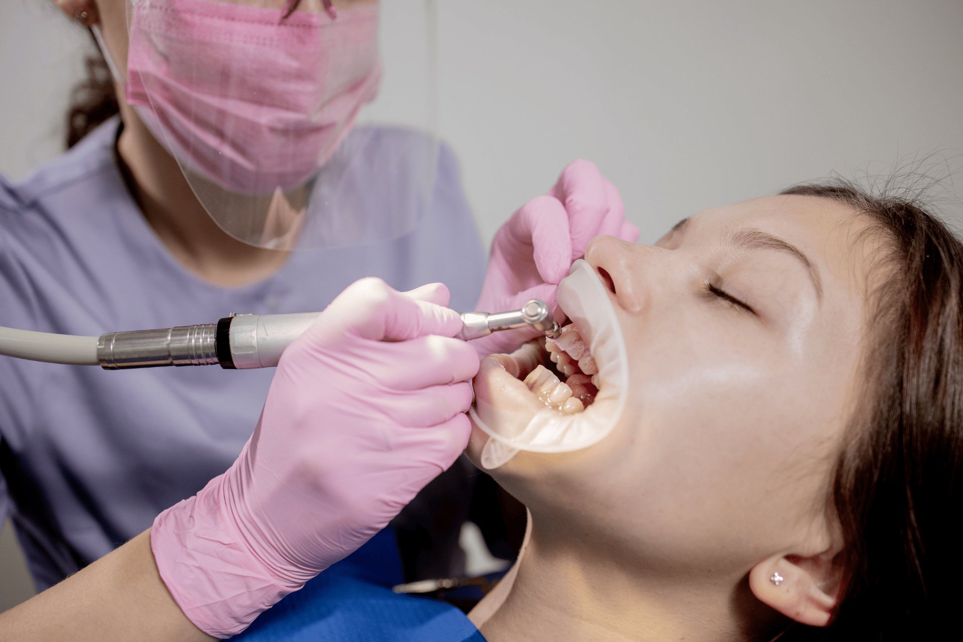 Image of sample for dental implants