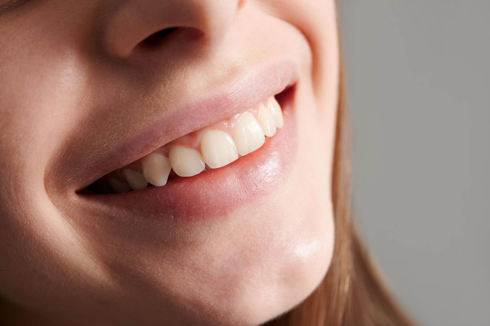 A close up of a woman 's smile with white teeth.