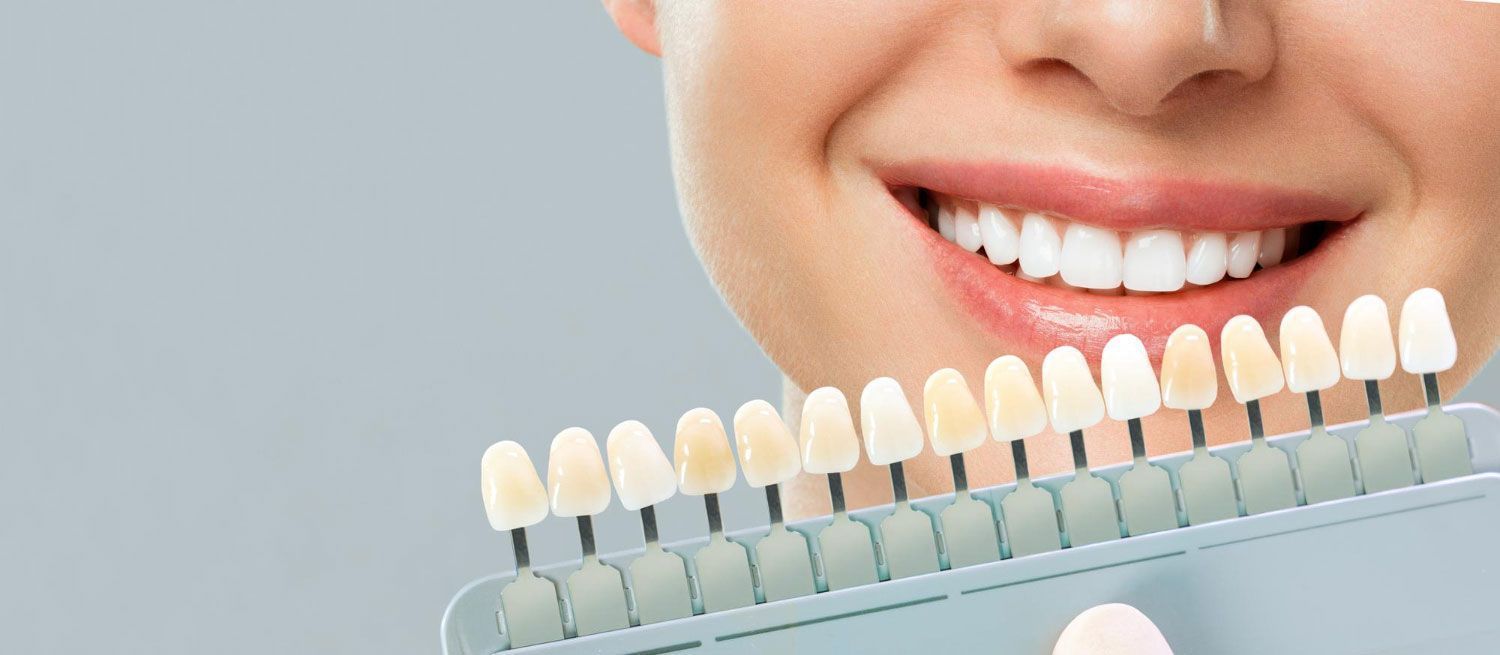 A woman is smiling while holding a tooth color chart in front of her teeth.