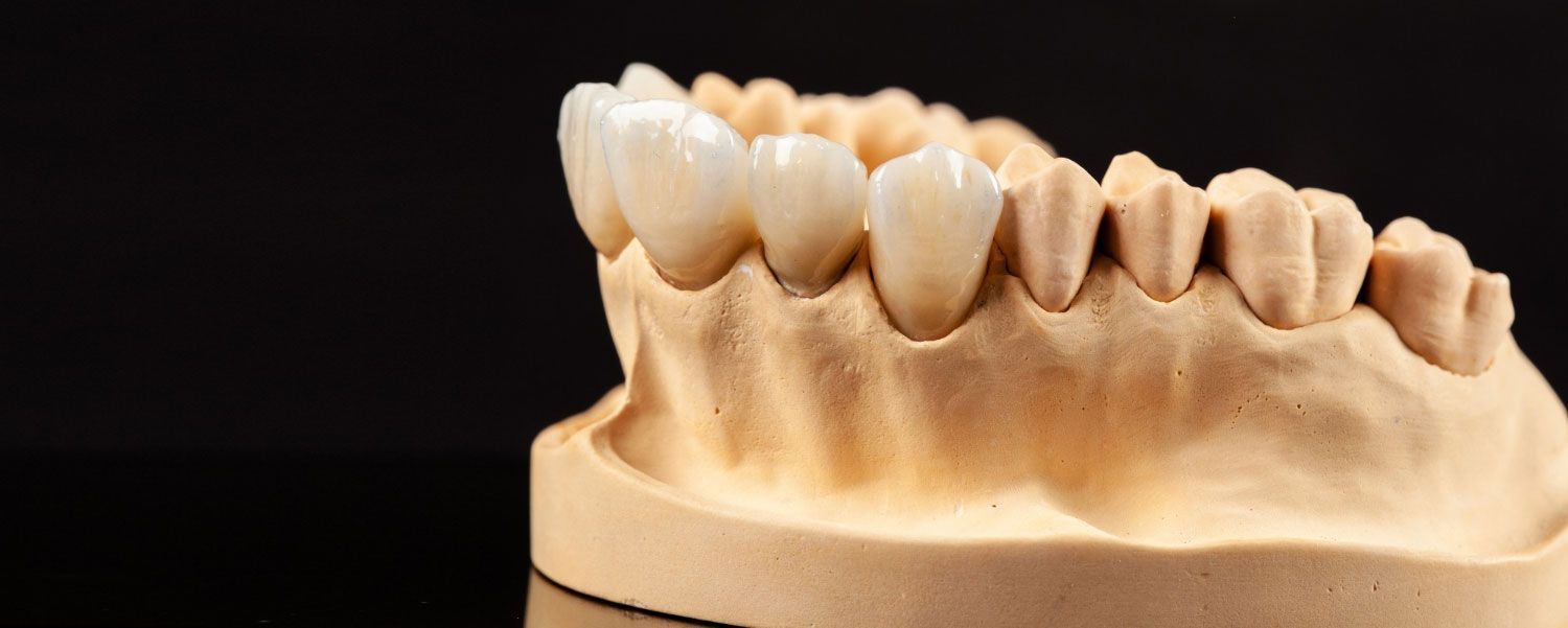 A close up of a model of a person 's teeth on a black background.