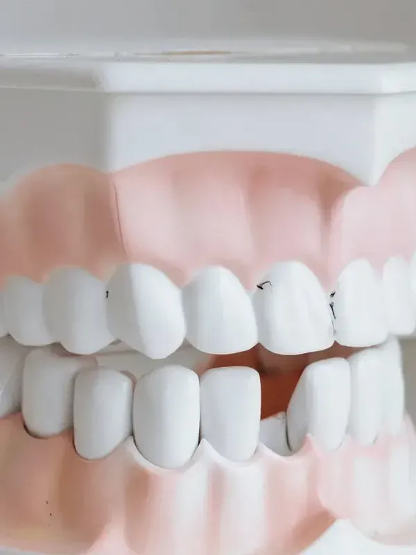 A close up of a model of a person 's teeth and gums.