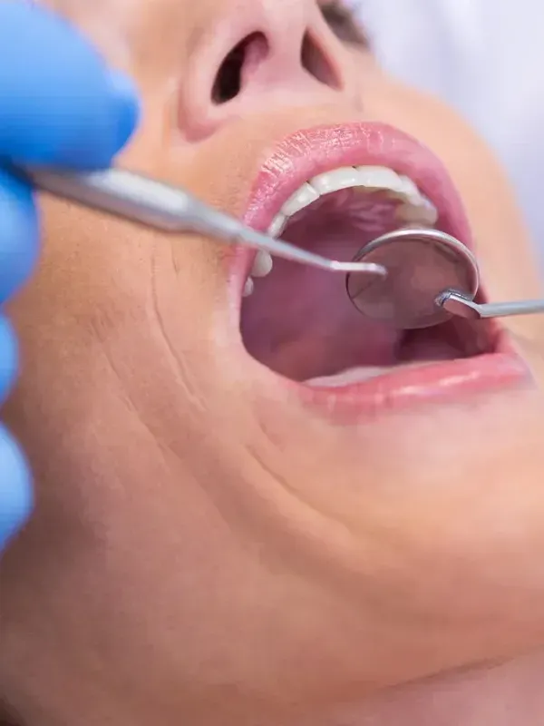 A woman is getting her teeth examined by a dentist.